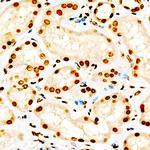 H3K9me2 Antibody in Immunohistochemistry (Paraffin) (IHC (P))