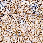 H3K9me2 Antibody in Immunohistochemistry (Paraffin) (IHC (P))