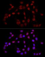 H3K27me3 Antibody in Immunocytochemistry (ICC/IF)