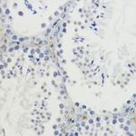 H4K20me2 Antibody in Immunohistochemistry (Paraffin) (IHC (P))