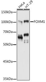 FOXM1 Antibody in Western Blot (WB)