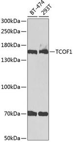 TCOF1 Antibody in Western Blot (WB)