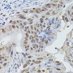 MRE11 Antibody in Immunohistochemistry (Paraffin) (IHC (P))