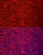 APLP1 Antibody in Immunohistochemistry (Paraffin) (IHC (P))