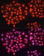 ABCB8 Antibody in Immunocytochemistry (ICC/IF)