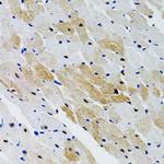 SHP2 Antibody in Immunohistochemistry (Paraffin) (IHC (P))