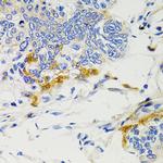 SHP2 Antibody in Immunohistochemistry (Paraffin) (IHC (P))