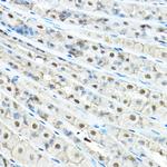 VCP Antibody in Immunohistochemistry (Paraffin) (IHC (P))