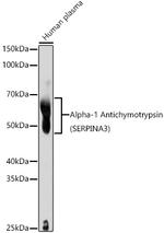 SERPINA3 Antibody in Western Blot (WB)