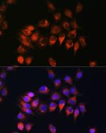 BDKRB2 Antibody in Immunocytochemistry (ICC/IF)