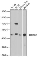 BDKRB2 Antibody in Western Blot (WB)