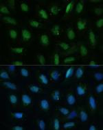 DUT Antibody in Immunocytochemistry (ICC/IF)