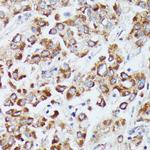 DUT Antibody in Immunohistochemistry (Paraffin) (IHC (P))