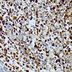 DUT Antibody in Immunohistochemistry (Paraffin) (IHC (P))