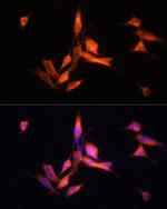 MMP10 Antibody in Immunocytochemistry (ICC/IF)