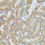 MMP10 Antibody in Immunohistochemistry (Paraffin) (IHC (P))