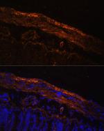 MYL9 Antibody in Immunohistochemistry (Paraffin) (IHC (P))