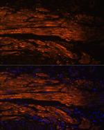 MYL9 Antibody in Immunohistochemistry (Paraffin) (IHC (P))