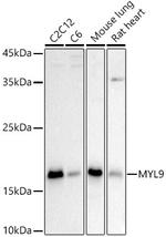 MYL9 Antibody in Western Blot (WB)