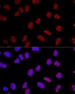 AKAP8 Antibody in Immunocytochemistry (ICC/IF)