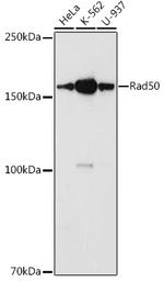 RAD50 Antibody in Western Blot (WB)