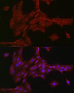 NOTCH3 Antibody in Immunocytochemistry (ICC/IF)