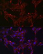 MKP3 Antibody in Immunocytochemistry (ICC/IF)