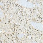 MKP3 Antibody in Immunohistochemistry (Paraffin) (IHC (P))