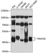 TRMT2B Antibody in Western Blot (WB)