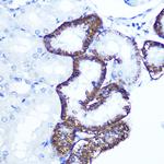 EXTL3 Antibody in Immunohistochemistry (Paraffin) (IHC (P))