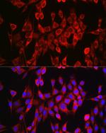 Glutaminase Antibody in Immunocytochemistry (ICC/IF)