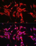 Glutaminase Antibody in Immunocytochemistry (ICC/IF)