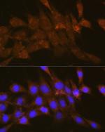 OSBP Antibody in Immunocytochemistry (ICC/IF)