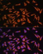 PMM2 Antibody in Immunocytochemistry (ICC/IF)