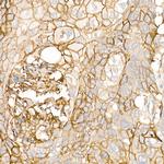 Thrombomodulin Antibody in Immunohistochemistry (Paraffin) (IHC (P))