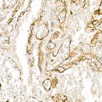 Thrombomodulin Antibody in Immunohistochemistry (Paraffin) (IHC (P))