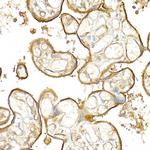 Thrombomodulin Antibody in Immunohistochemistry (Paraffin) (IHC (P))