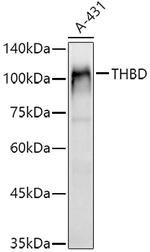 Thrombomodulin Antibody in Western Blot (WB)