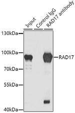 RAD17 Antibody in Immunoprecipitation (IP)