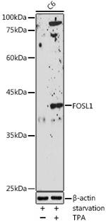 Fra1 Antibody in Western Blot (WB)