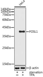 Fra1 Antibody in Western Blot (WB)