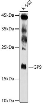 CD42a Antibody in Western Blot (WB)