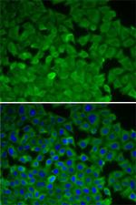 EEF2K Antibody in Immunocytochemistry (ICC/IF)