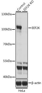 EEF2K Antibody in Western Blot (WB)