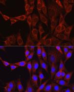 Glutamine Synthetase Antibody in Immunocytochemistry (ICC/IF)