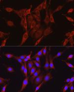 Glutamine Synthetase Antibody in Immunocytochemistry (ICC/IF)