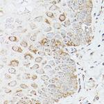 Glutamine Synthetase Antibody in Immunohistochemistry (Paraffin) (IHC (P))