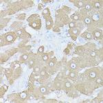 Glutamine Synthetase Antibody in Immunohistochemistry (Paraffin) (IHC (P))