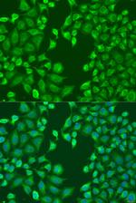 MERTK Antibody in Immunocytochemistry (ICC/IF)