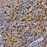 MERTK Antibody in Immunohistochemistry (Paraffin) (IHC (P))